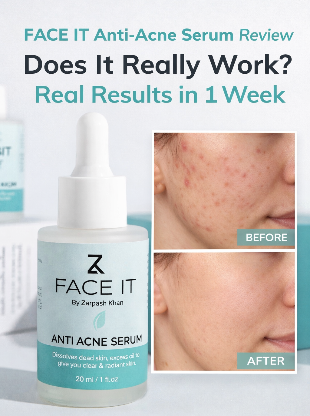 Face It Anti-Acne Serum Review: Does It Really Work? Real Results in 1 Week
